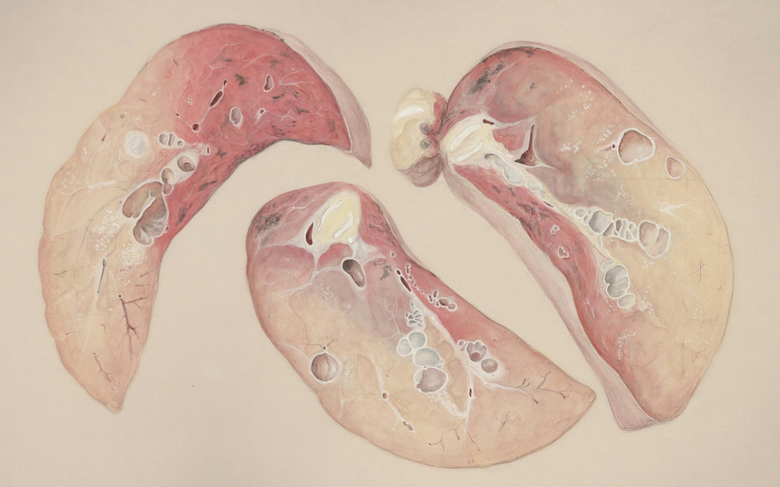 Unlock the Power of Improved Respiration: A Guide to Breathing Retraining for Better Health