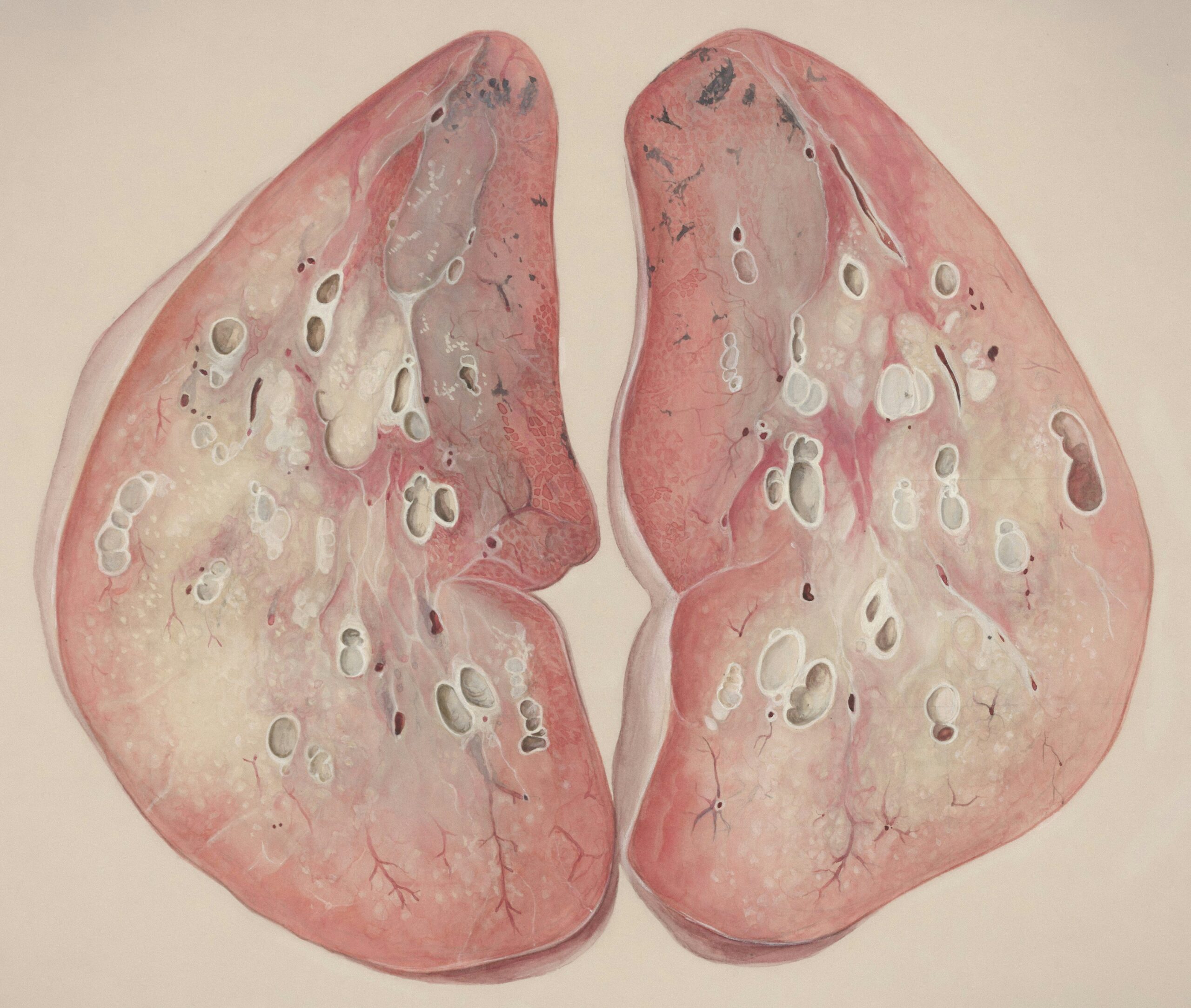 Comparison chart of different breathing exercises and their benefits